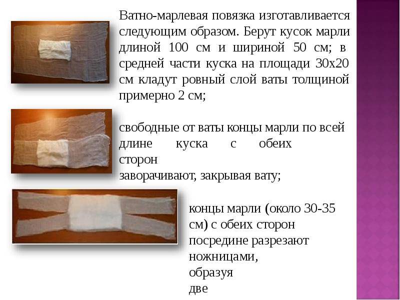 Ватно марлевая повязка презентация