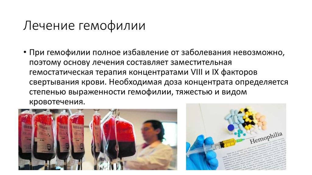 Почему в королевских семьях была гемофилия?